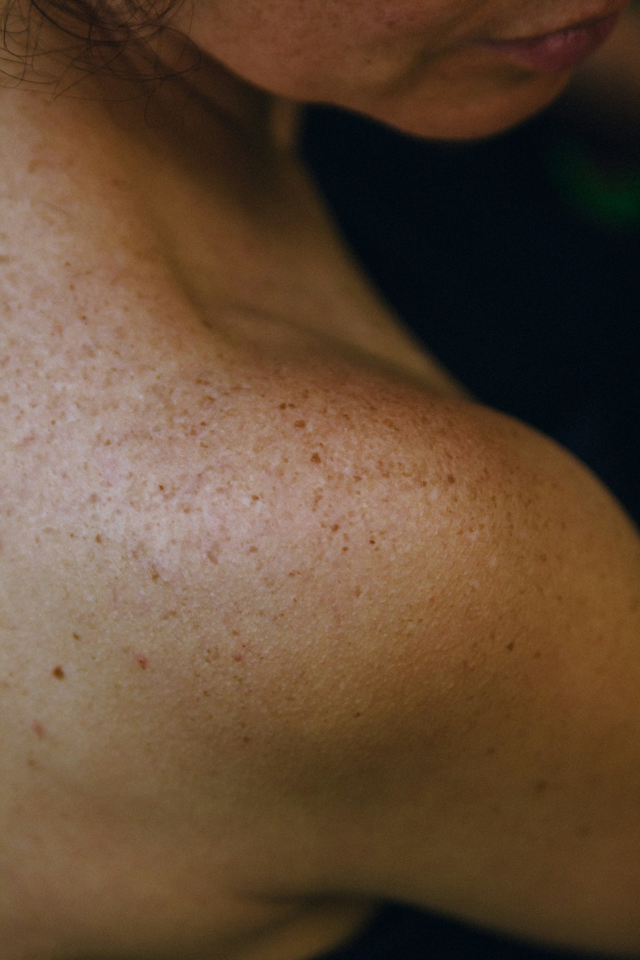 Arm Fat & Bingo Wings — Body