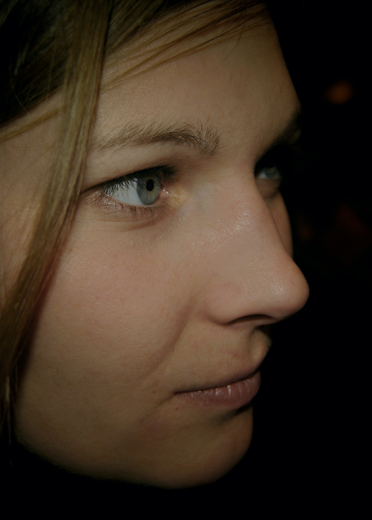 Volume loss & collagen depletion — concern category