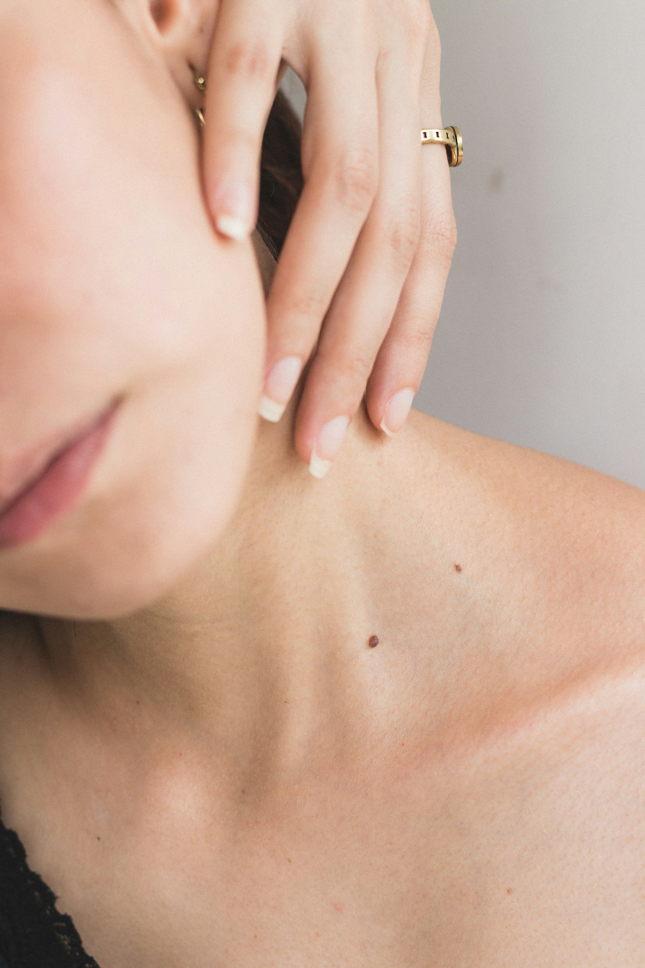 Sagging Skin (Skin Laxity) — Body