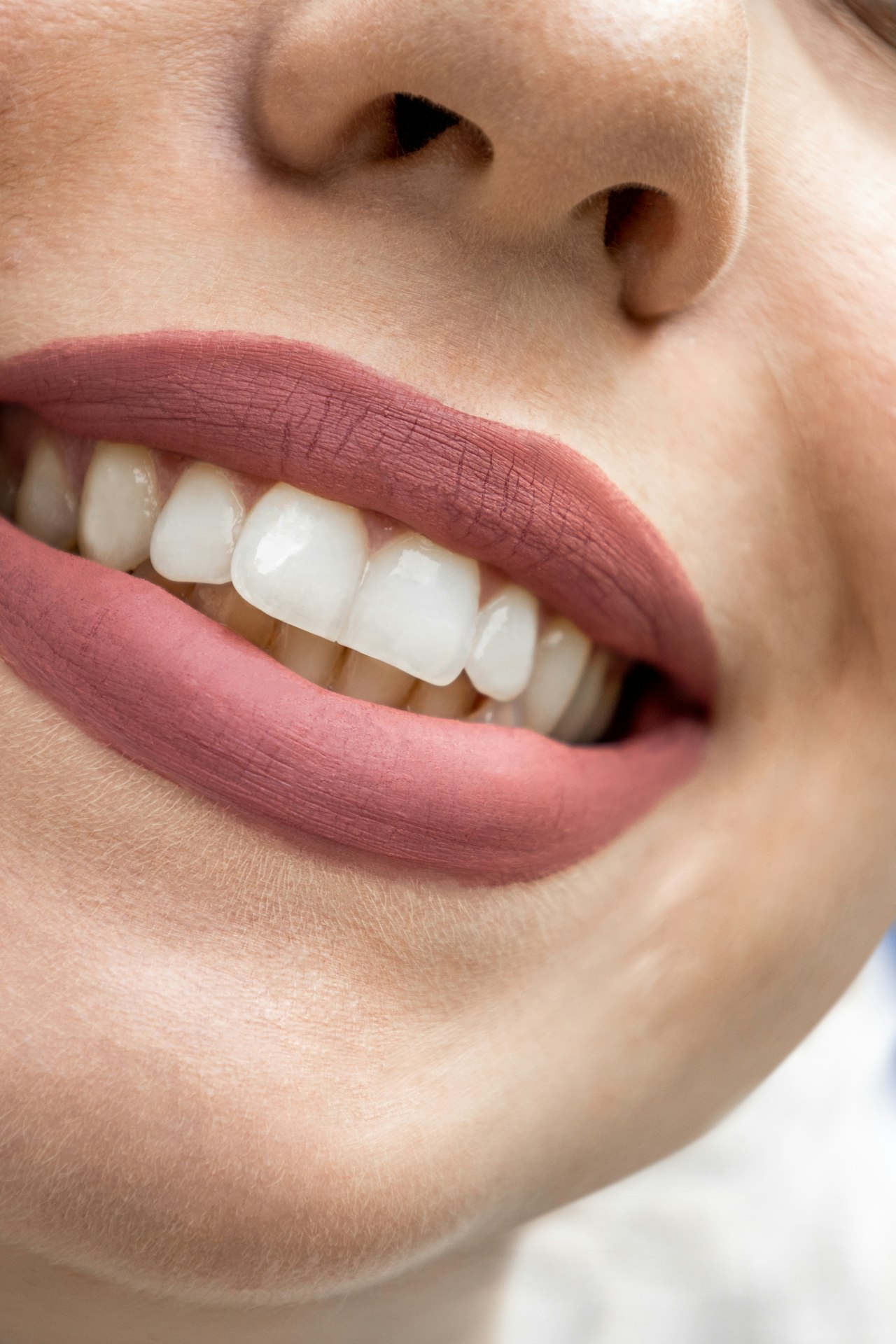 Barcode Lines Around Lips — Face