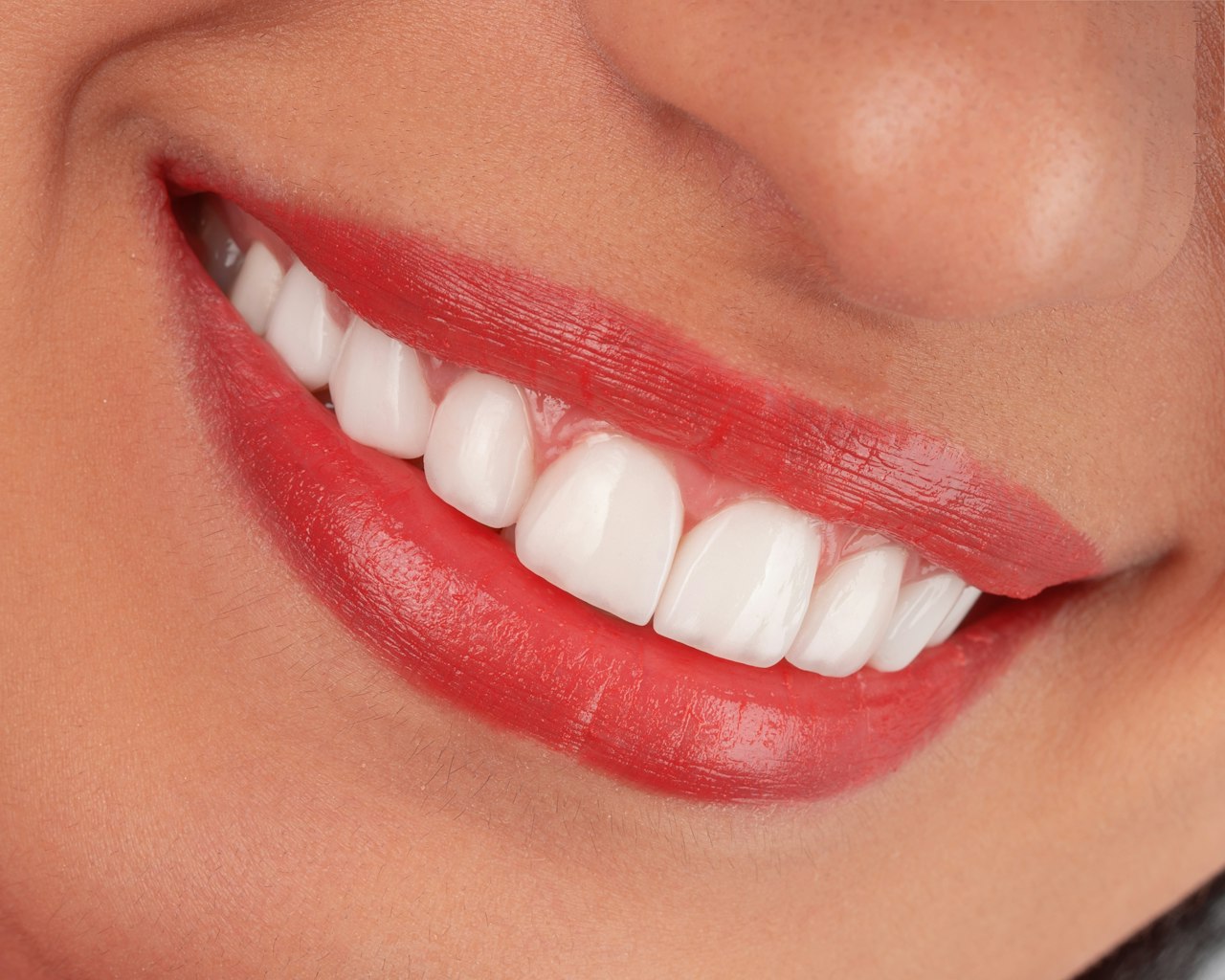Gummy Smile — Face