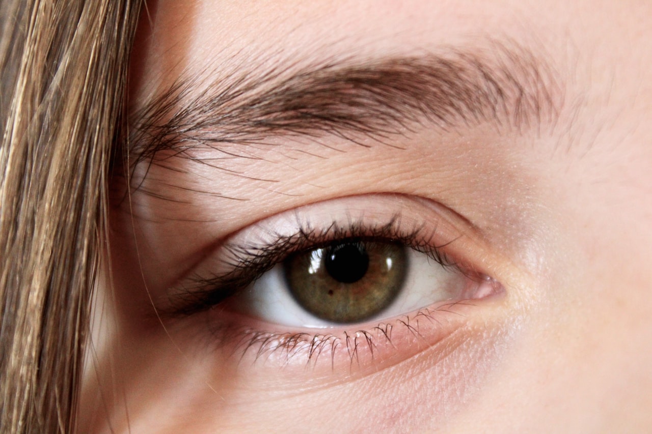 Eye area — concern category