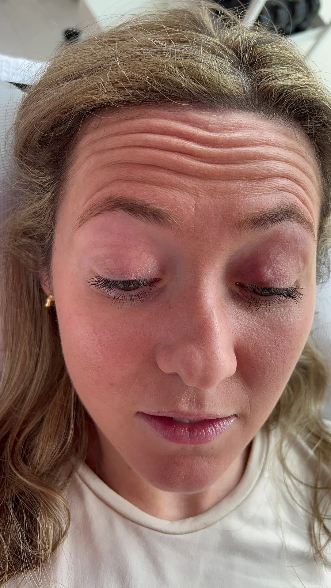 Before — Dynamic Line Softening